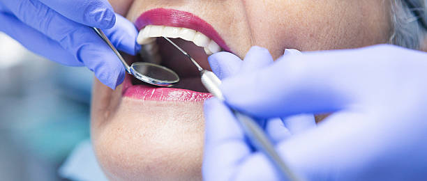 Best Emergency Tooth Extraction in Dallas, NC